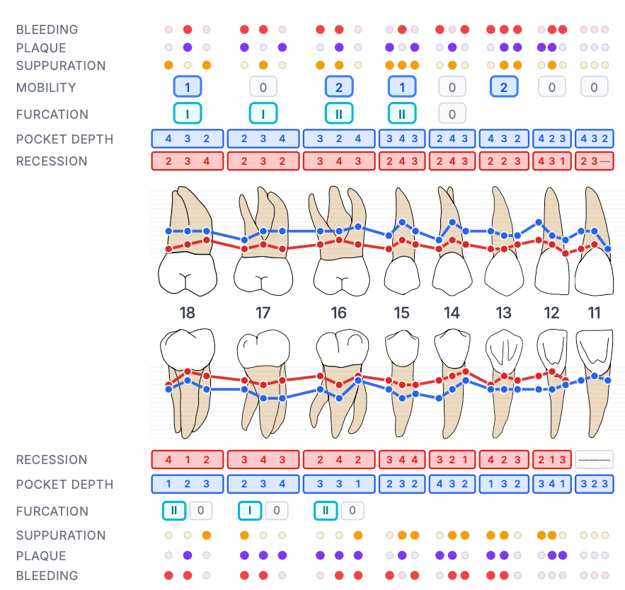 Chart parodontal réaliste pour l'éducation des patients
